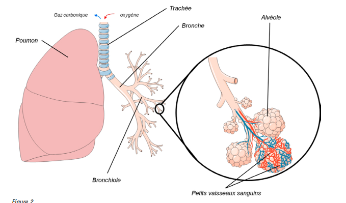 hemosiderose pulmonaire